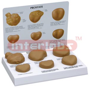 Prostate